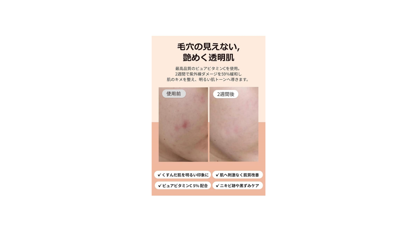 Klairs Fresh Juice Vitamin Drops, 1.2 fl oz (35 ml), Korean Cosmetics, Skin Essence, Vitamin C Serum, Home Care, Pores, Dry Skin, Moisture, Skin Care, Hypoallergenic, Cosmetics Gift